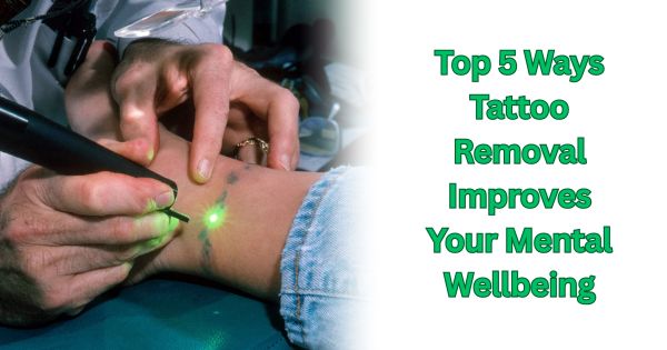 Top 5 Ways Tattoo Removal Improves Your Mental Wellbeing