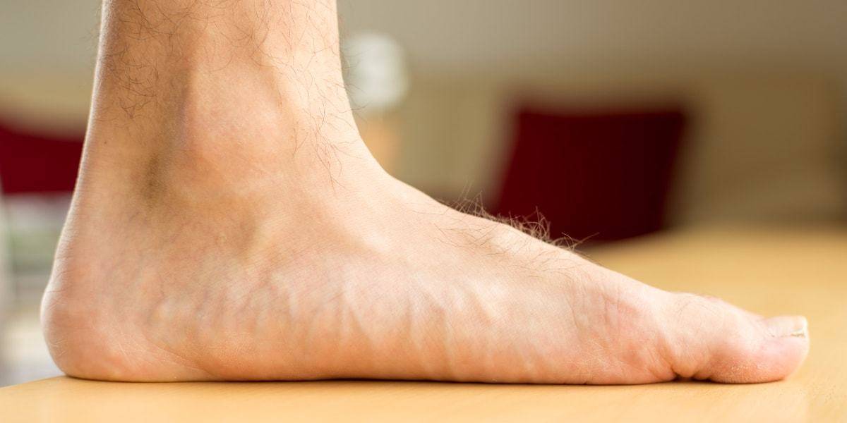 Symptoms Of Flat Feet