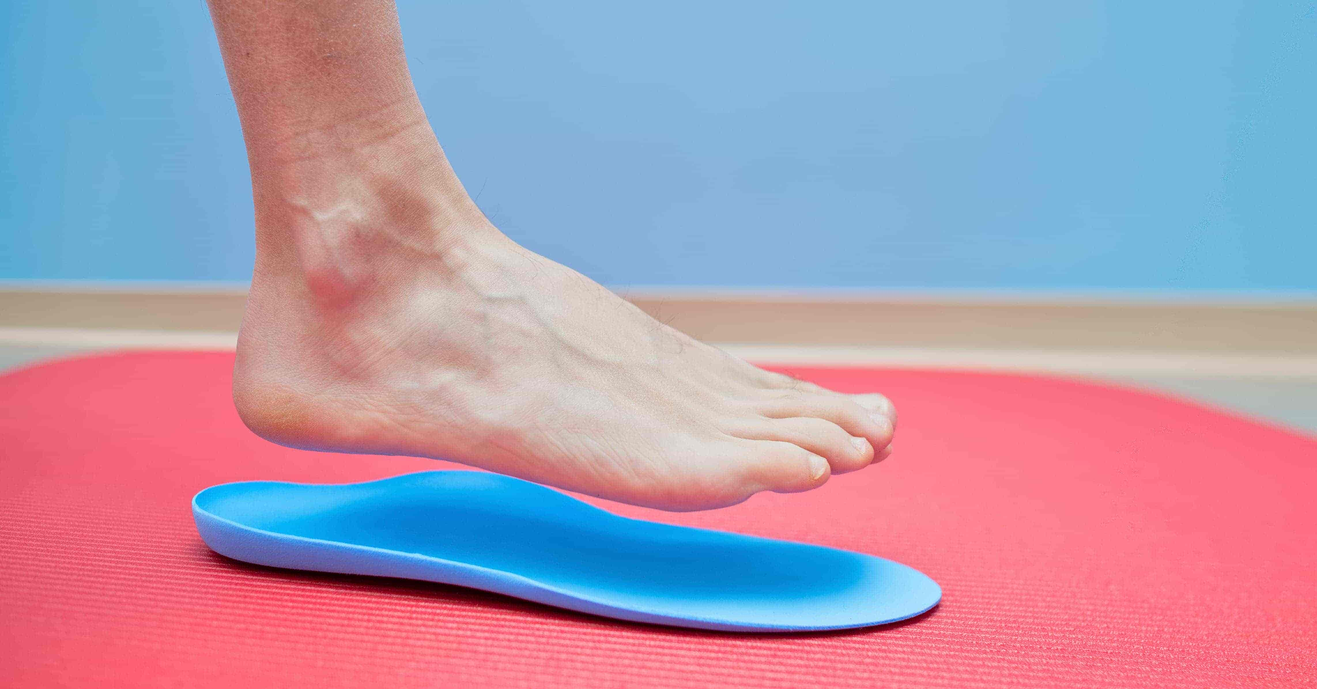 Treatment Of Flat Feet