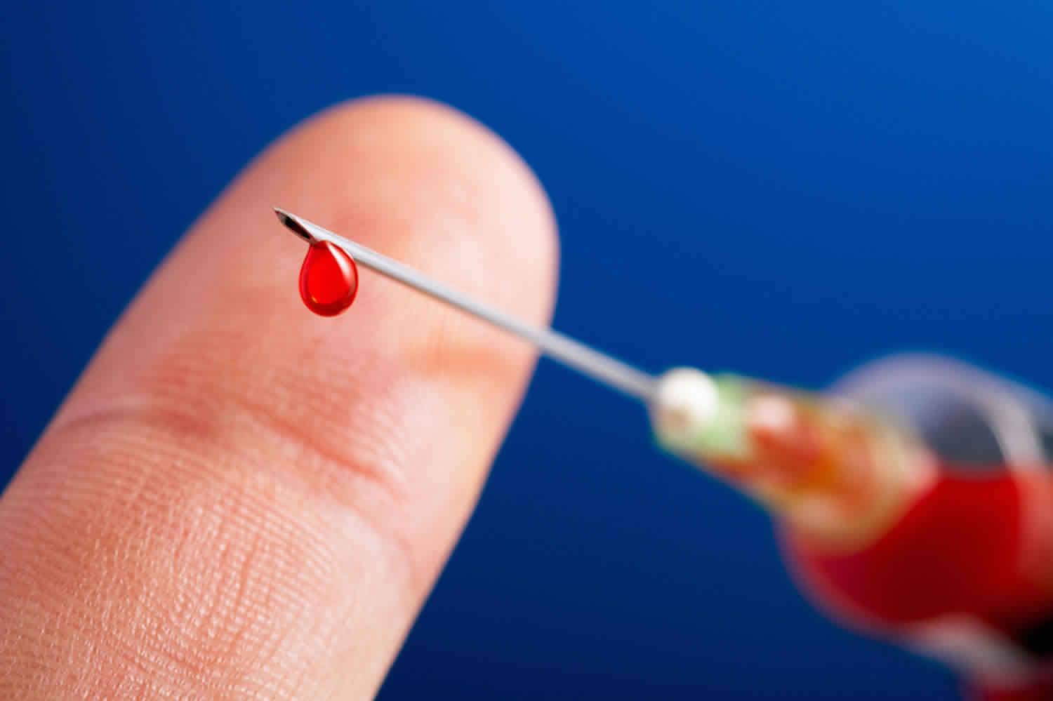 Why Current Safety Devices Are Not Solving the Needlestick Issue