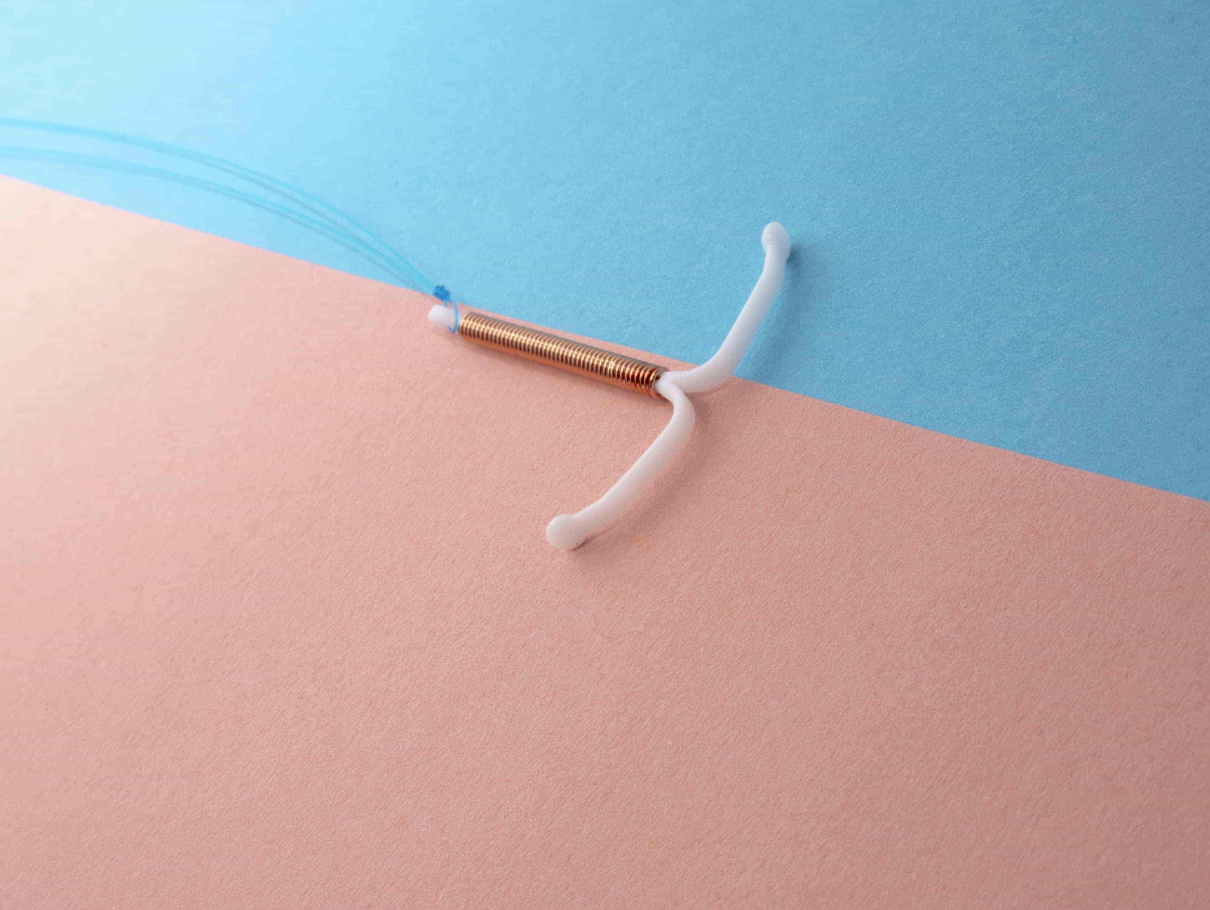 IUD Insights: Addressing Clinical Issues in Long-Term Contraceptive Methods