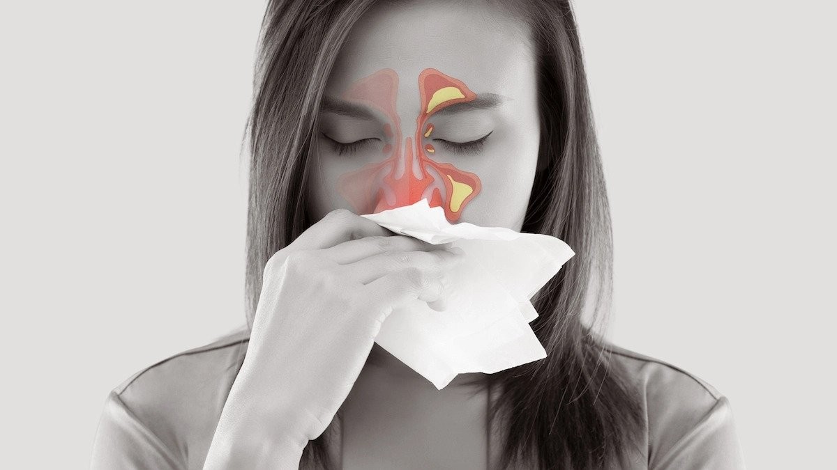 Are bacterial sinus infections contagious?