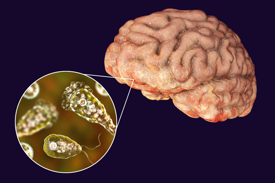 Brain-Eating Amoeba: Common Areas, Treatment, Recent Cases