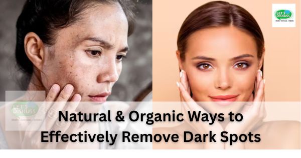 Natural & Organic Ways to Effectively Remove Dark Spots