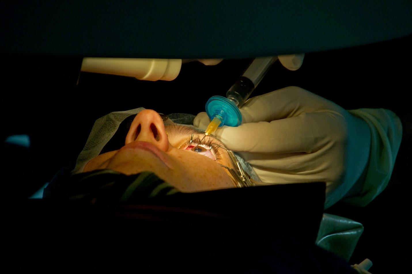 What You Need to Know about Laser Eye Surgery in NYC